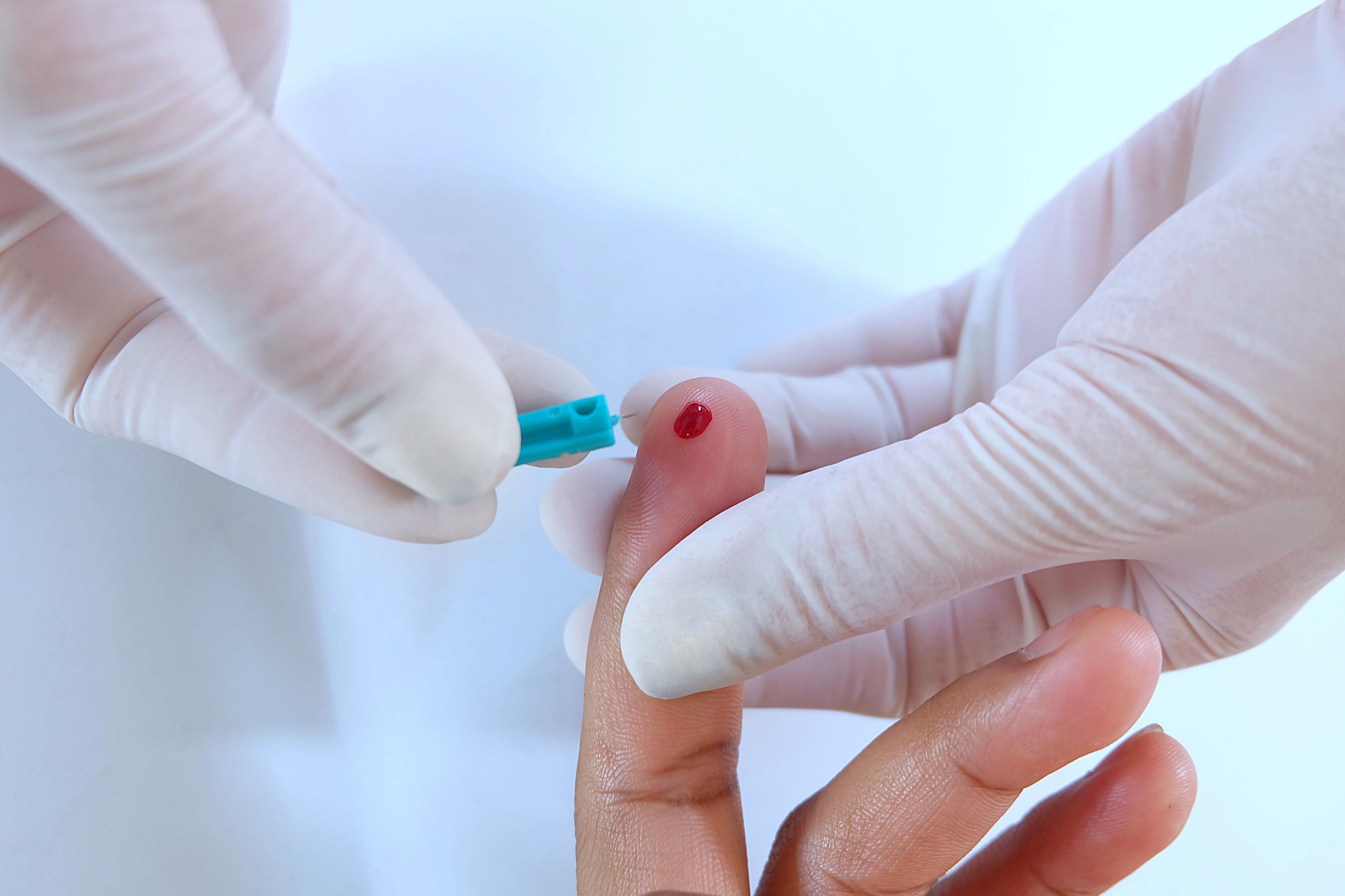 Pediatric Blood Draws and Heel Sticks