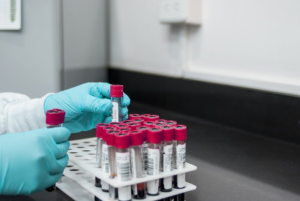 Blood in vials being placed in a holder.