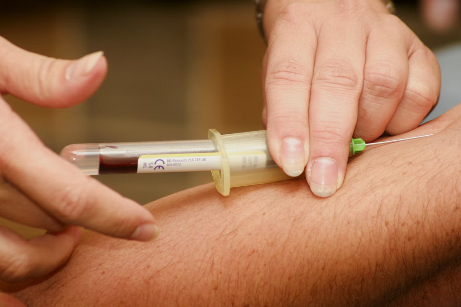 4 Benefits of Home Blood Draw Services Phlebotomy on Wheels
